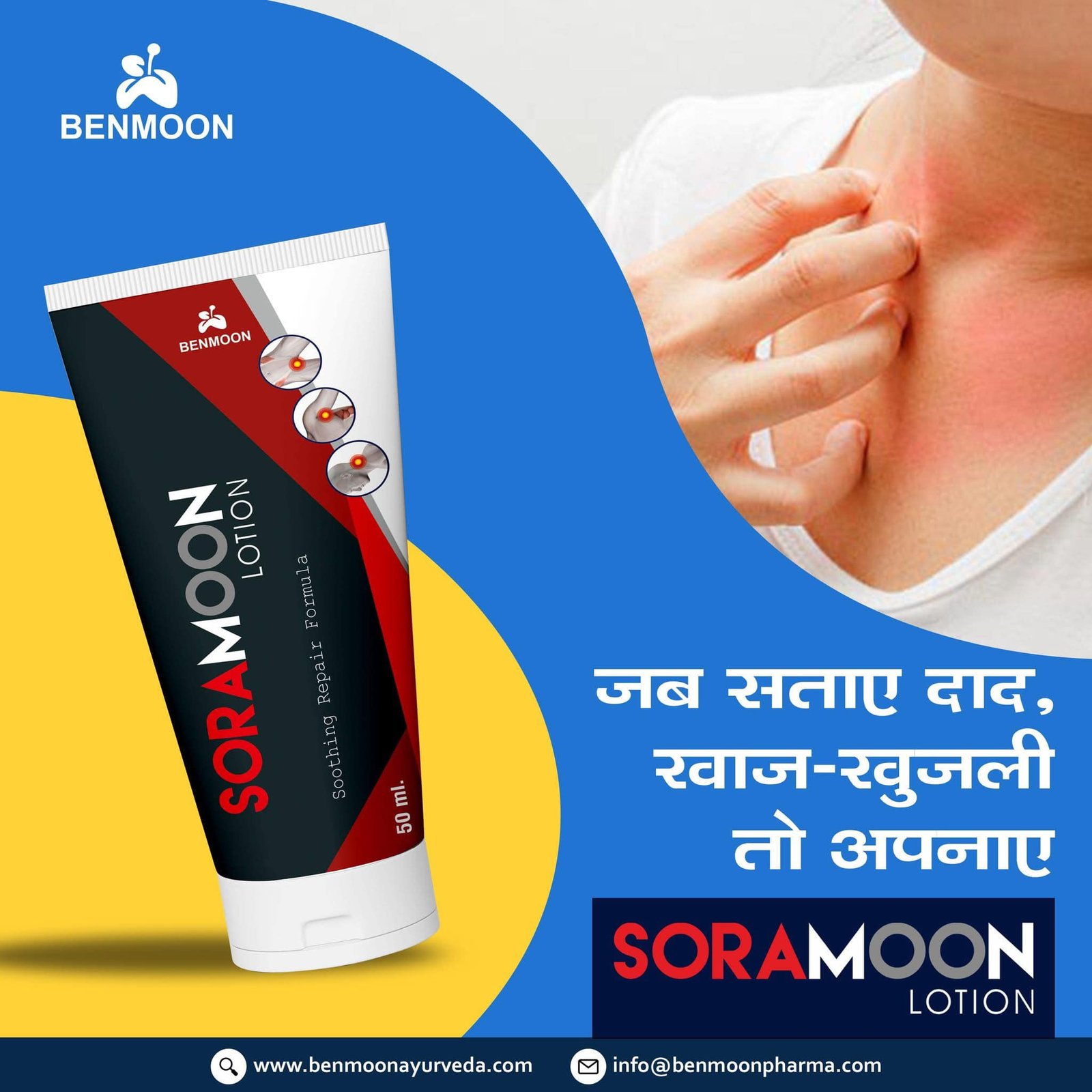 Soramoon Lotion For Daad Khaaj Khujli